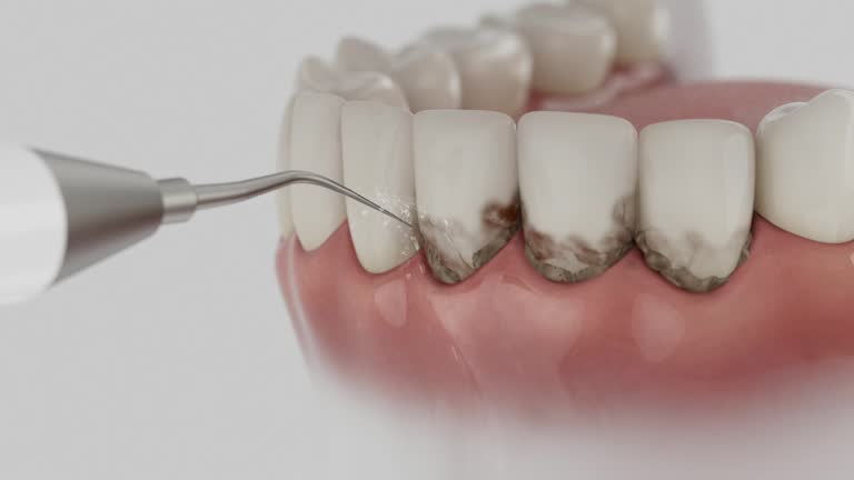 Trusted Root Canal Treatment service in DeLand Southwest, FL - Dentist Open Now
